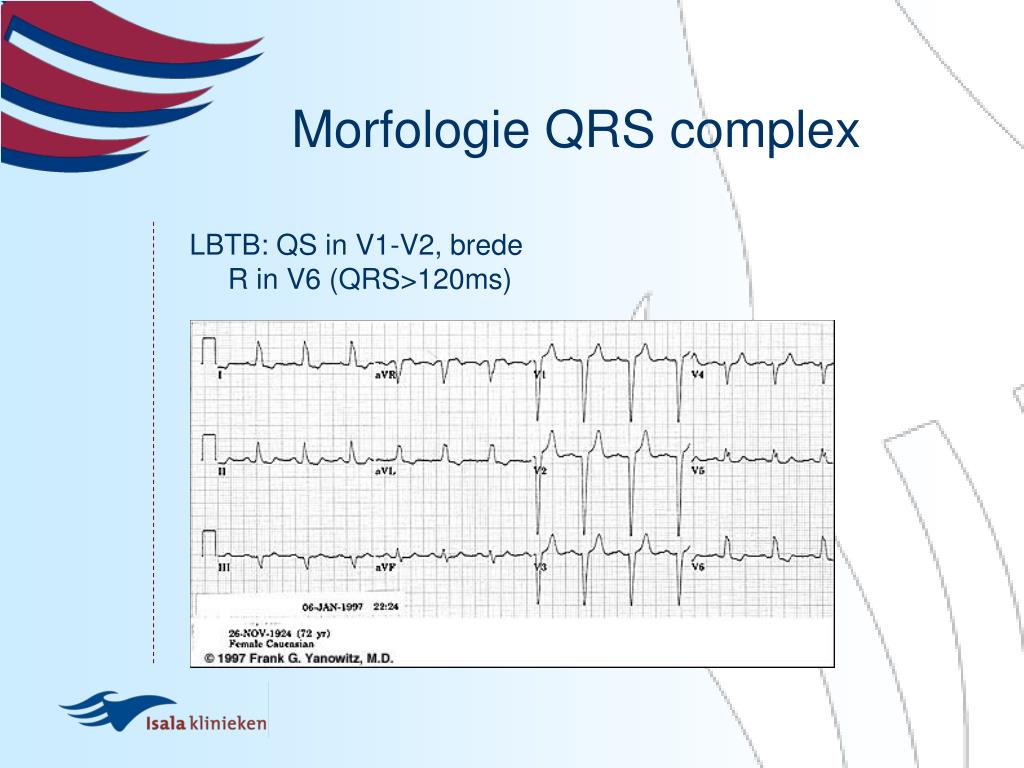 PPT - ECG-onderwijs: Ritme- en geleidingsstoornissen PowerPoint ...