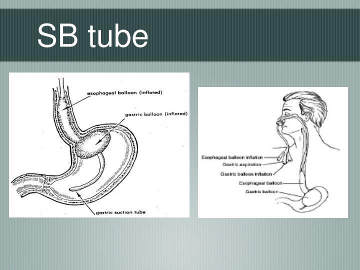 PPT GI Bleeds The Basics PowerPoint Presentation ID3402521