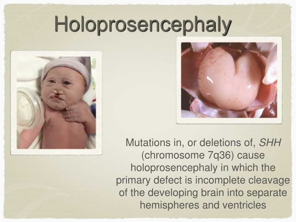 PPT Developmental Genetics And Birth Defects PowerPoint Presentation 