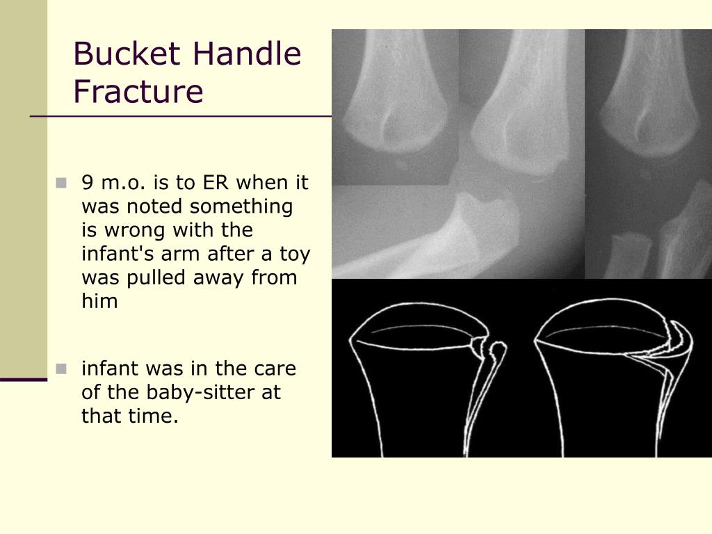 PPT MCCQE 1 Preparation PowerPoint Presentation, free download ID