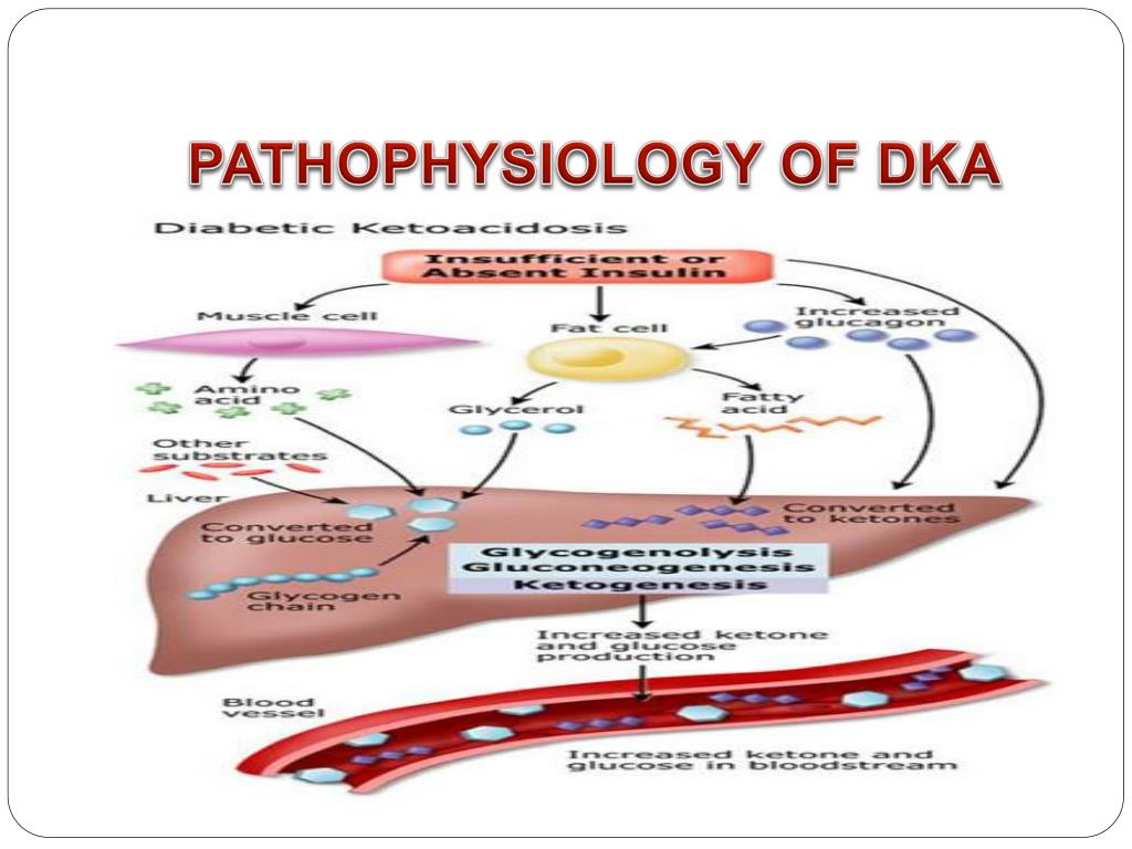 case study presentation dka