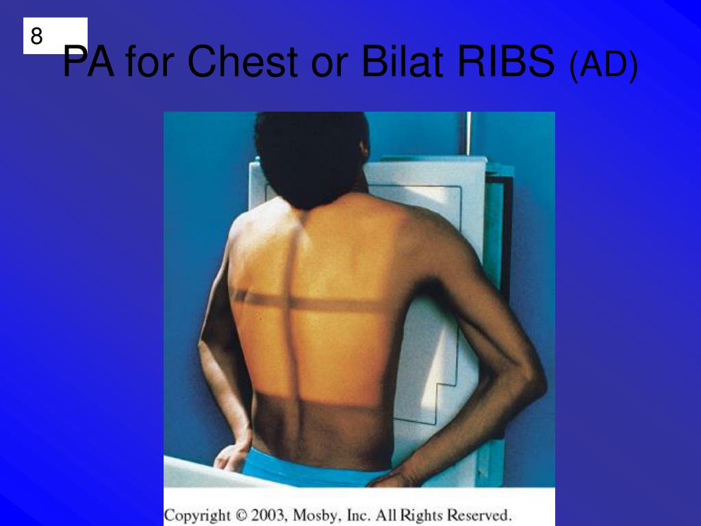 Ad Rib Medical PPT - PA -anterior side BEST SEEN AP -posterior side BEST SEEN ...