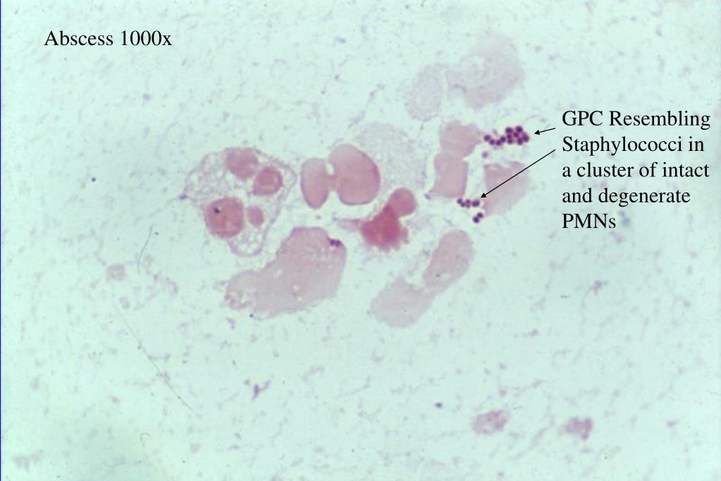 Ppt Gram Stain Review Powerpoint Presentation Free