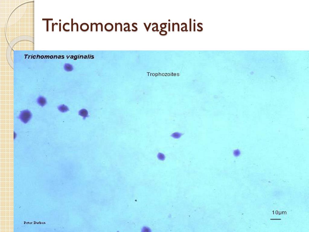 Ppt Trichomonas Vaginalis Ve Zg R Amipler Powerpoint Presentation Id