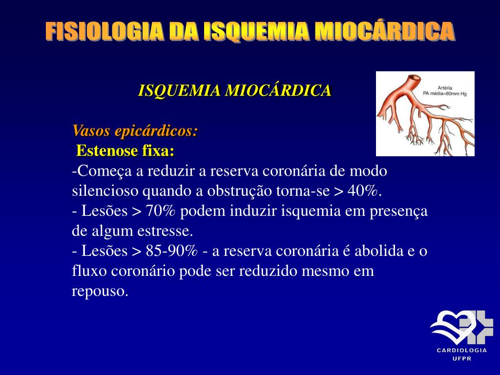 Resumo da Síndrome de Wellens: classificação e mais!, image size:1024x768
