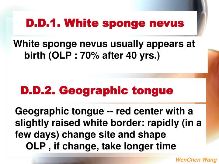 PPT 1. White lesions of the oral mucosa 2. Solitary oral ulcer and