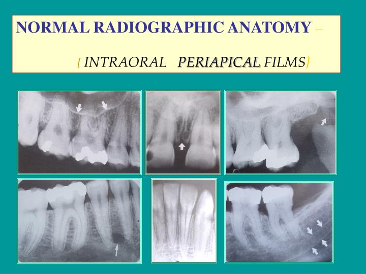 PPT NORMAL ANATOMICAL RADIOGRAPHIC LANDMARKS PowerPoint Presentation
