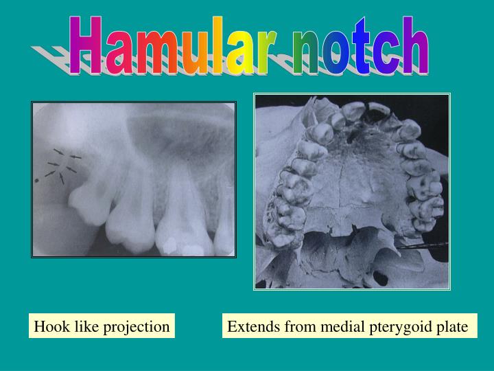 hamular notch