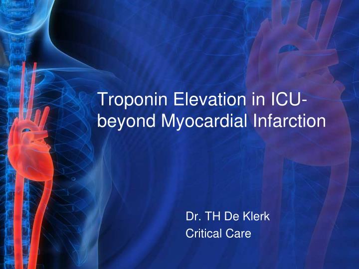 PPT - Troponin Elevation in ICU- beyond Myocardial Infarction ...