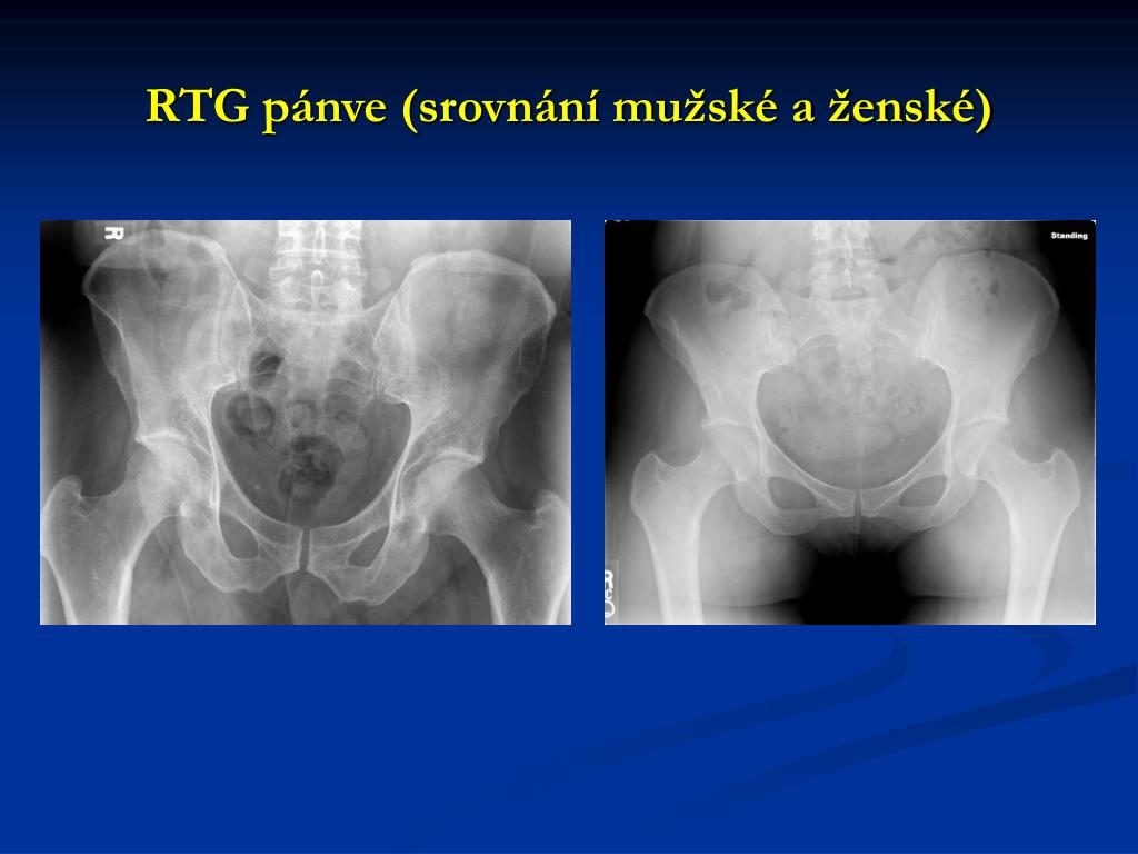 PPT - Anatomie dolní končetiny na RTG, CT, MRI PowerPoint Presentation -  ID:3483637