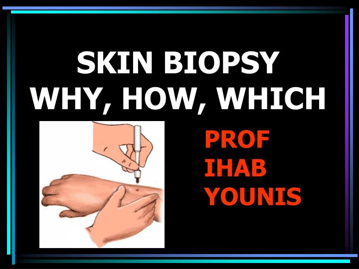 skin biopsy why how which n.