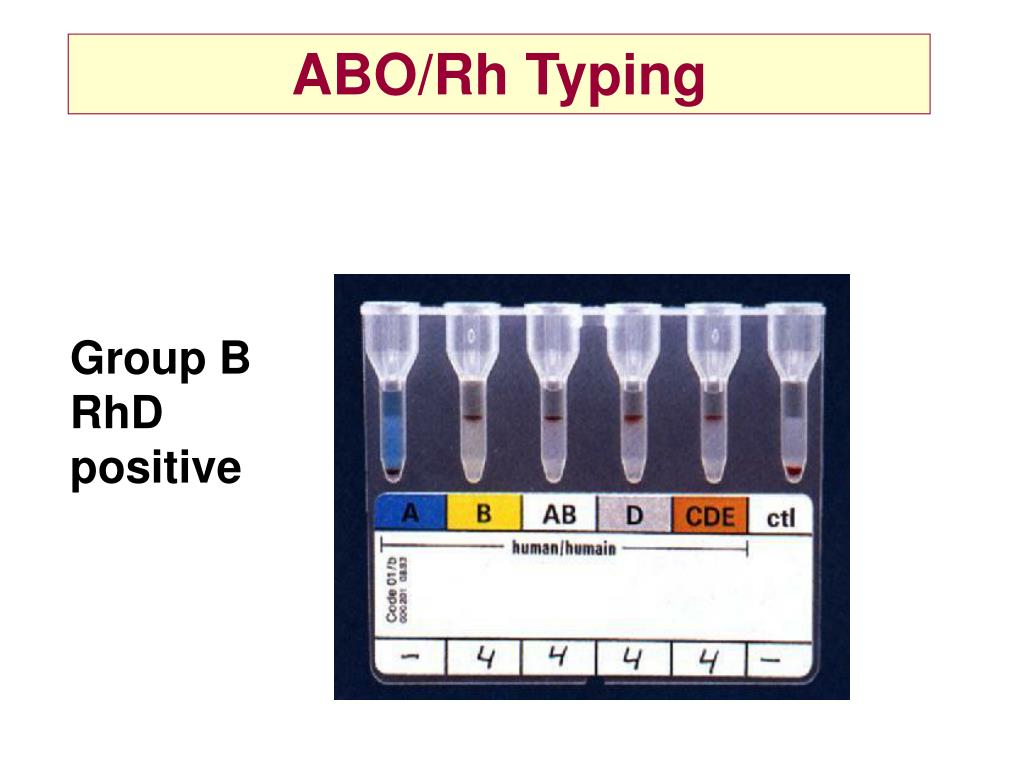 PPT - Blood Transfusion Dr Emer Lawlor, IBTS 3rd February 2003 ...