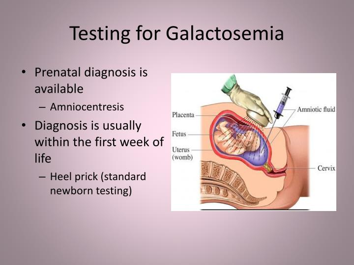 PPT - Galactosemia PowerPoint Presentation - ID:3509645
