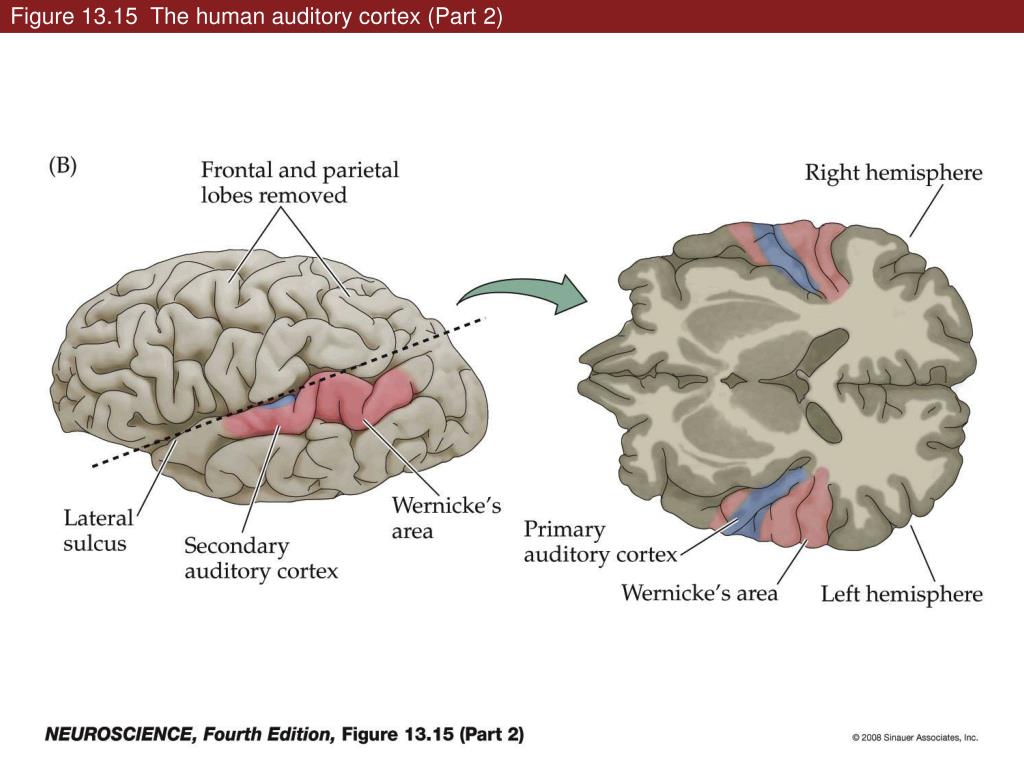 Слуховая зона мозга расположена. Первичная слуховая область коры больших полушарий:. Зона коры головного мозга слухового анализатора.