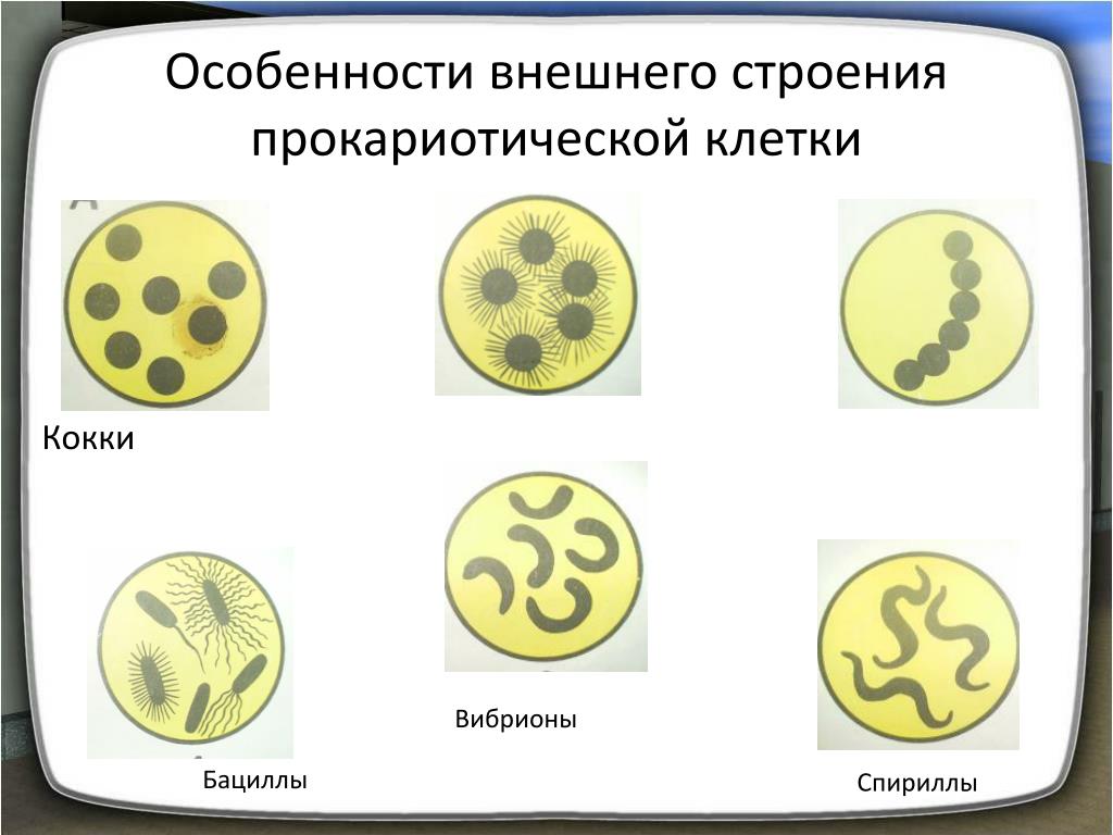 Прокариоты 10 класс. Форма прокариотической клетки. Форма клетки кокки. Кокки строение клетки. Кокки особенность строения клетки.
