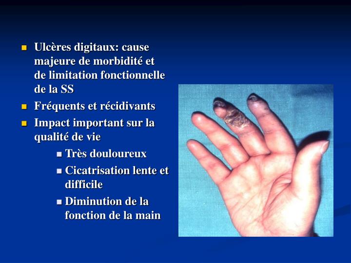 Atteinte Permanente Et Limitation Fonctionnelle Calcul Cnesst