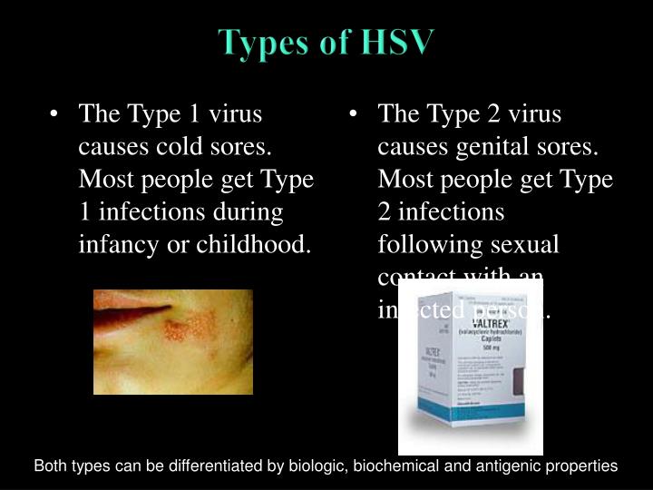 Hsv 1 Vs 2 _ Herpes Simplex Virus – WKWI
