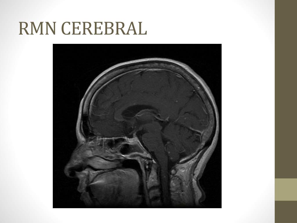 rmn cerebral rmn cerebral