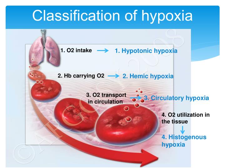 PPT - Hypoxia PowerPoint Presentation - ID:3560655