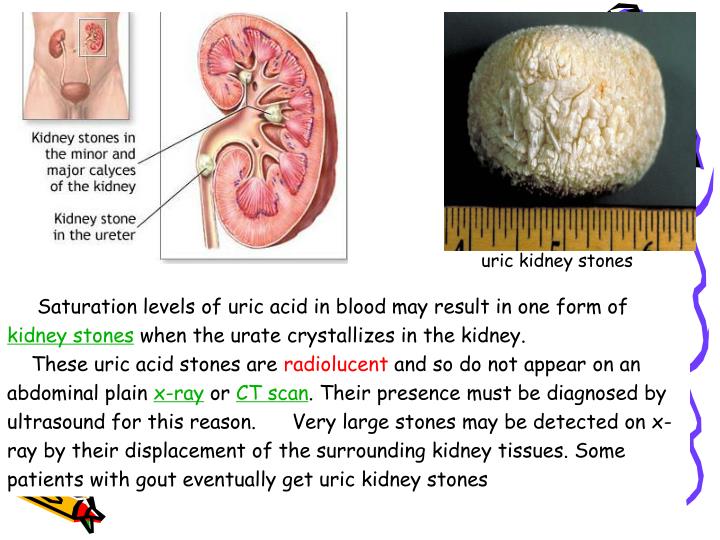 ppt-uric-acid-powerpoint-presentation-id-3568648