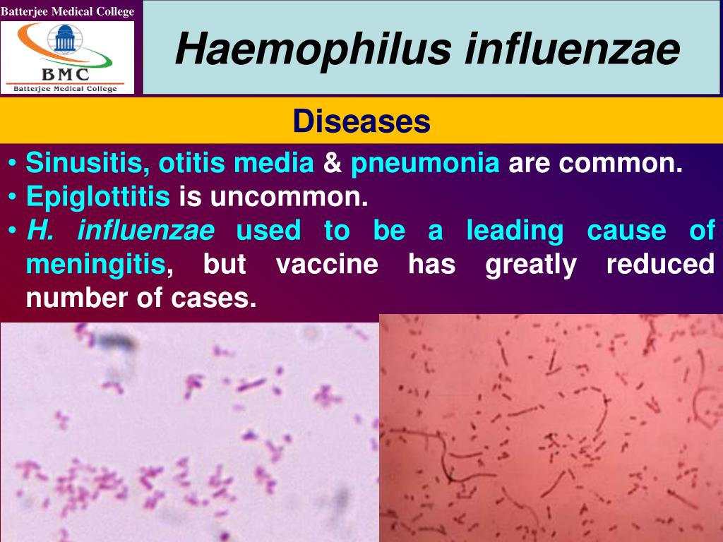 Haemophilus influenzae в носу. Гемофильная палочка дыхание. Гемофильная инфекция этиология. Гемофильная палочка заболевания.