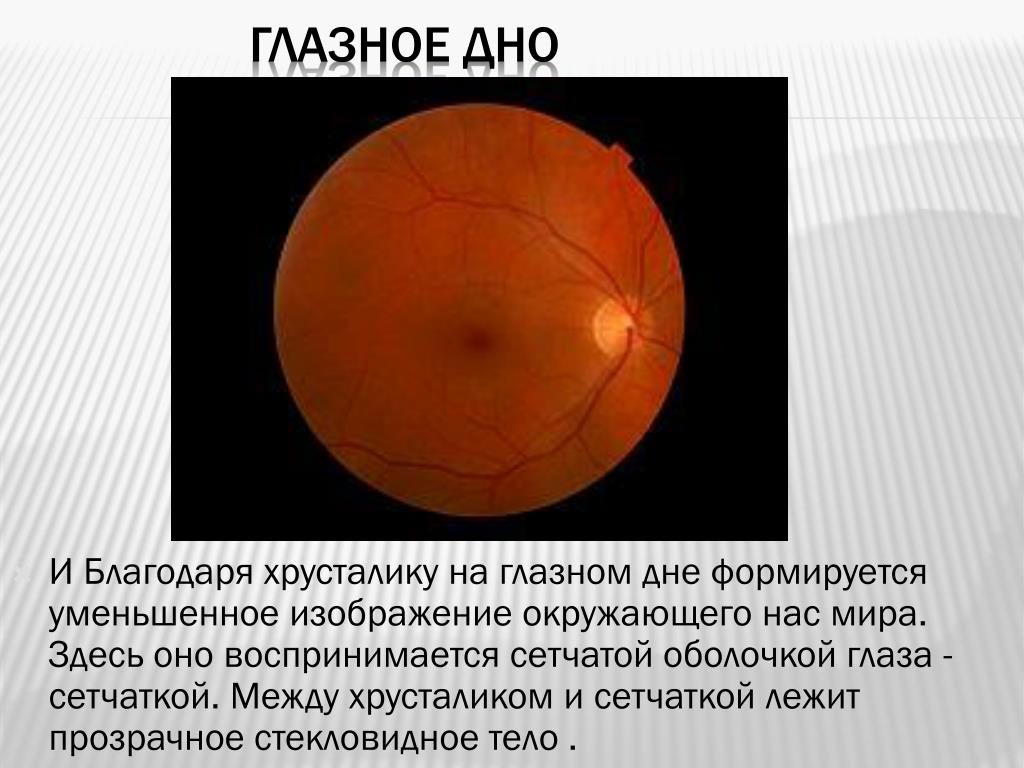 Норма глазного дна. Нанофтальм глазное дно. Изображение глазного дна.