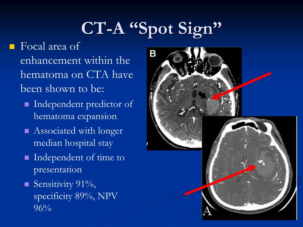 PPT - Intracranial Hemorrhage & Emergency Management of Increased ICP ...